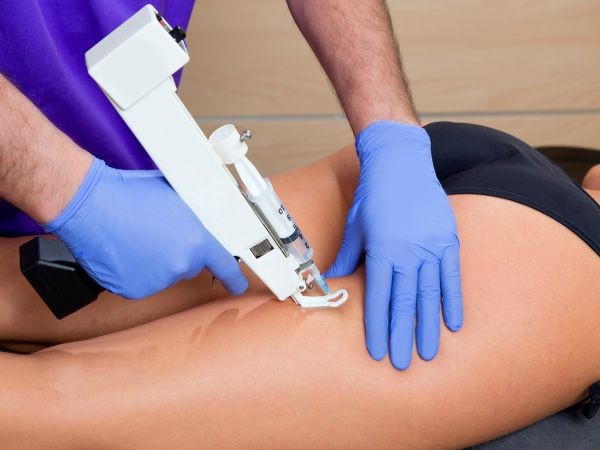 Mesoterapia