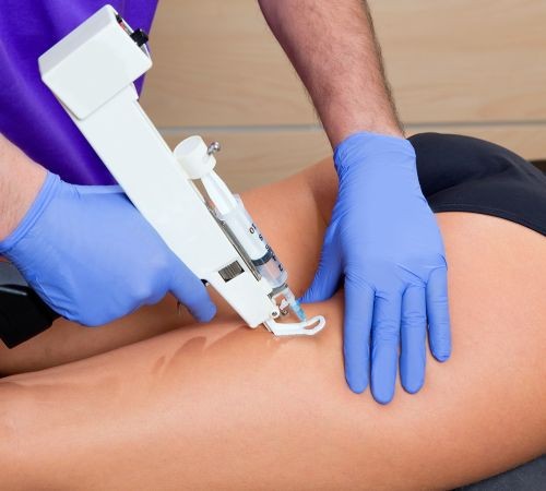 Mesoterapia